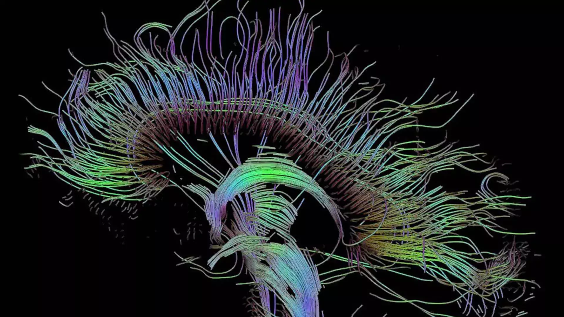 Neuroimaging