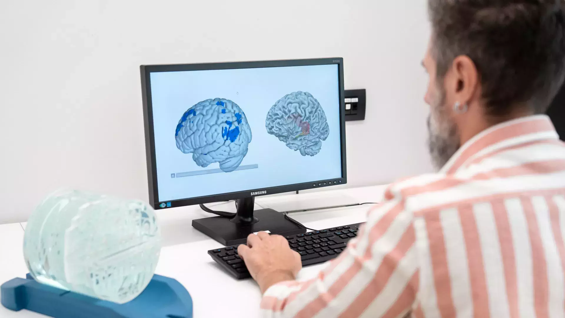 ricercatore di spalle con schermo PC, encefalo